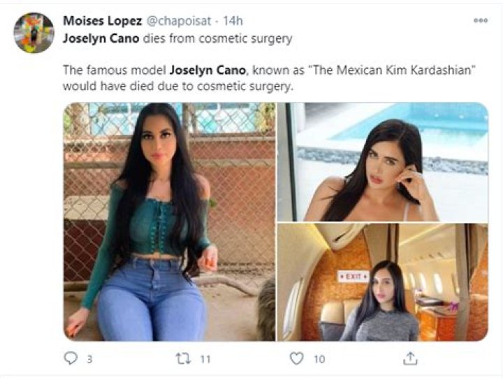 IG Model Known As "Mexican Kim Kardashian" Dies During Butt Surgery: Report