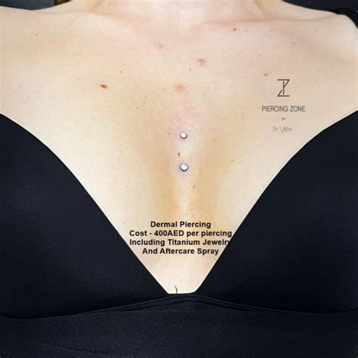 Offset Dermal Piercing Has Haters Branding Him A "Sassy Man"