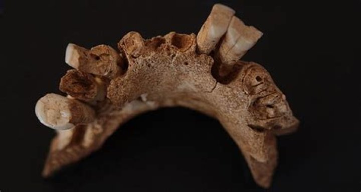 Why Cavemen's Teeth Were Healthier Than Ours