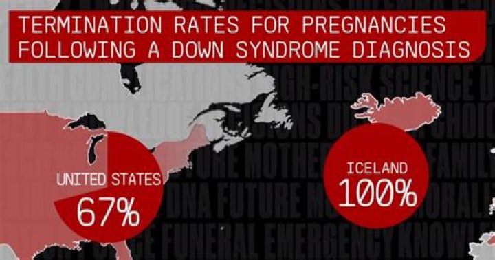 Down Syndrome Almost Eradicated In Iceland Thanks To Controversial Prenatal Screenings