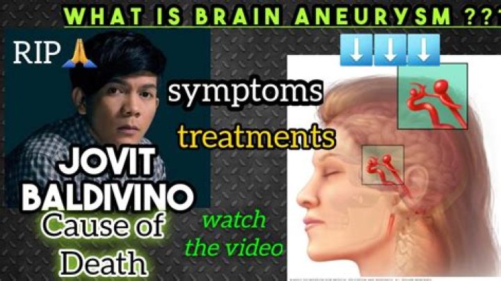 Jovit Baldivino Cause Of Death